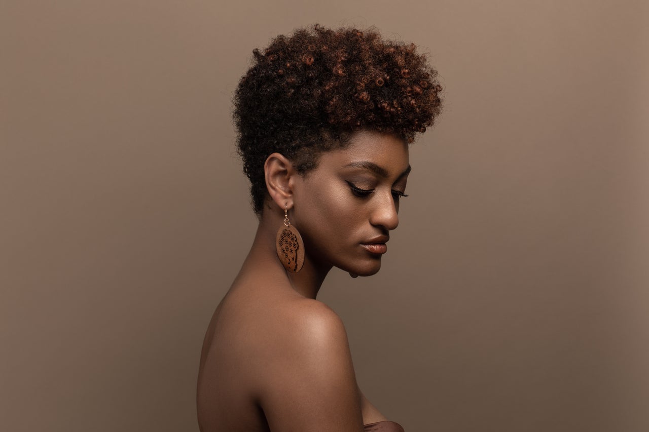 Trichoscopy Explained